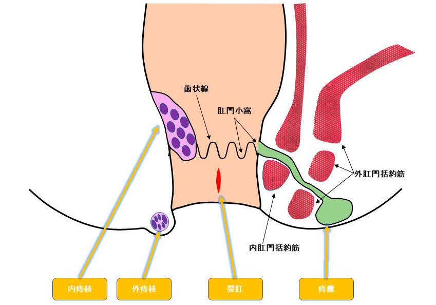 肛門外科　イメージ