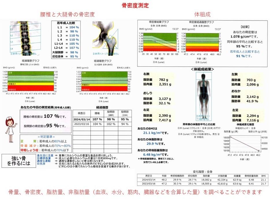 精密骨密度(X線)