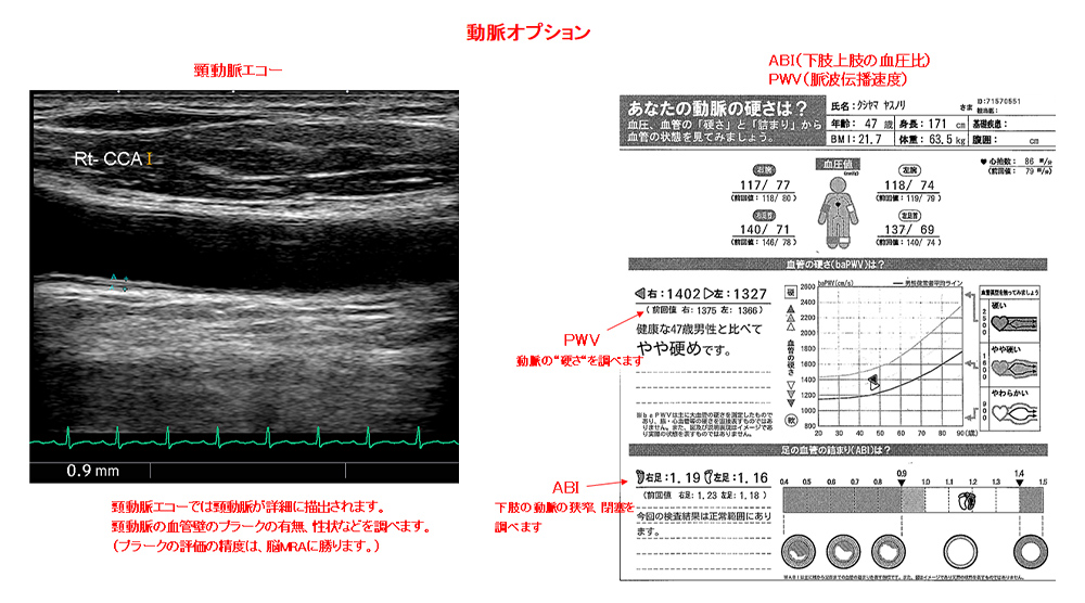 脳（頭部MRI・頭部MRA・頚部MRA）