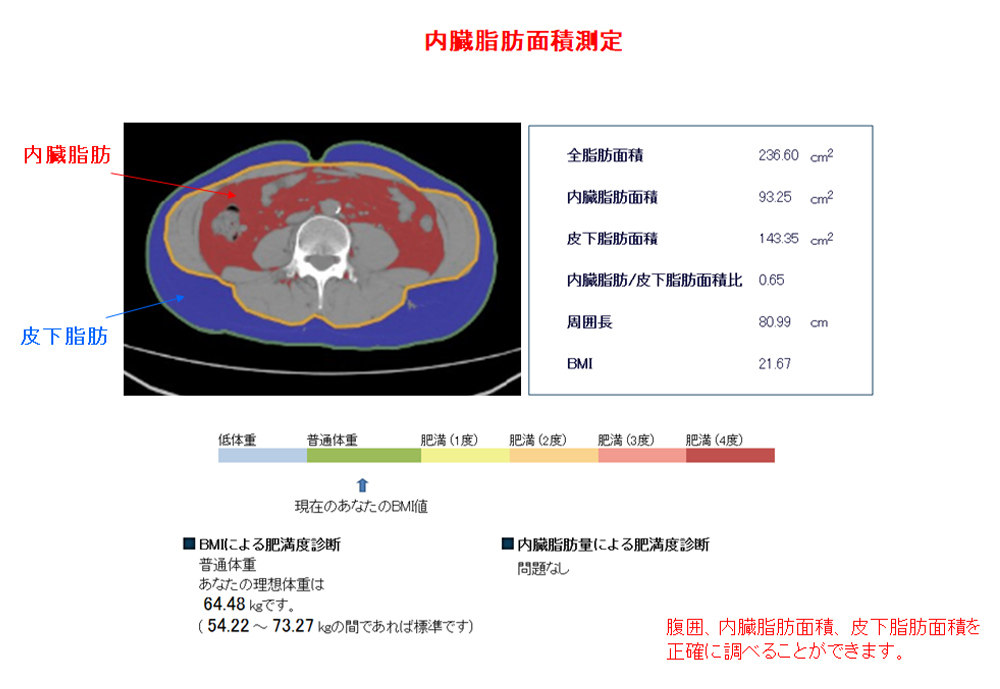 内臓脂肪面積測定